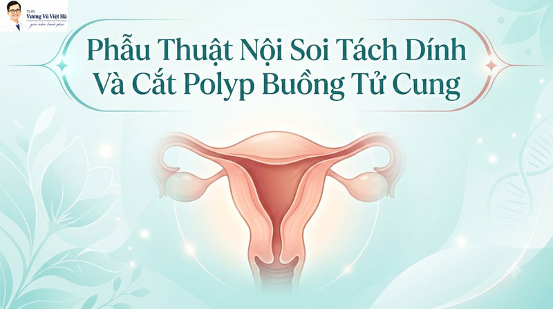 Nội soi cắt polyp buồng tử cung: Quy trình, biến chứng