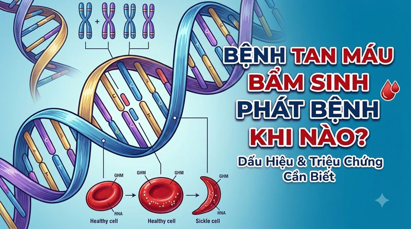 Bệnh Tan Máu Bẩm Sinh Phát Bệnh Khi Nào? Mốc Thời Gian & Dấu Hiệu Nhận Biết Sớm