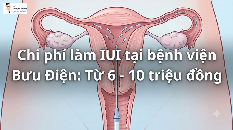 chi phí làm IUI tại bệnh viện Bưu Điện