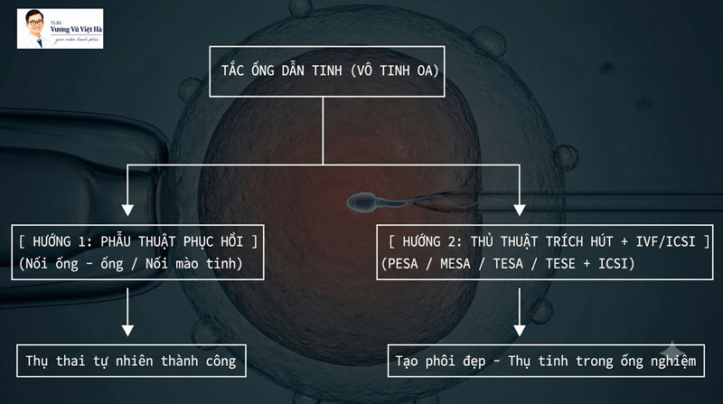 Hướng điều trị tắc ống dẫn tinh