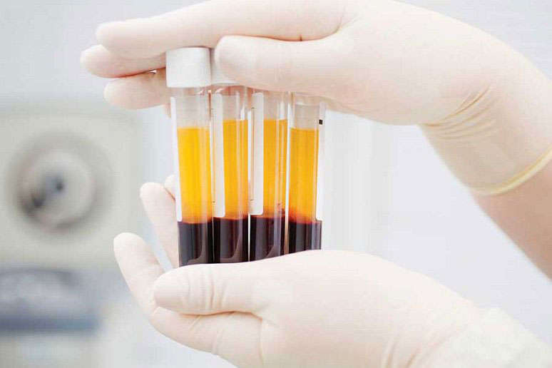 Bơm huyết tương giàu tiểu cầu làm dày niêm mạc tử cung (PRP)