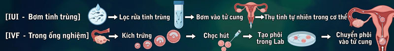 iui và ivf