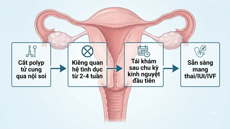 mổ polyp tử cung