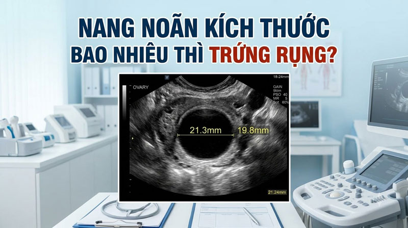Nang Noãn Kích Thước Bao Nhiêu Thì Trứng Rụng? Thời Điểm “Vàng” Thả Thai Của Chị Em