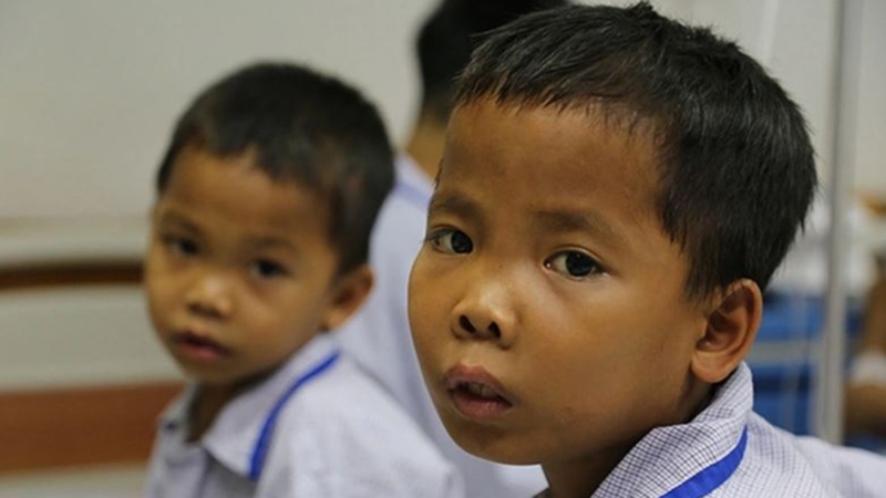 Nhận biết sớm qua hình ảnh trẻ bị tan máu bẩm sinh