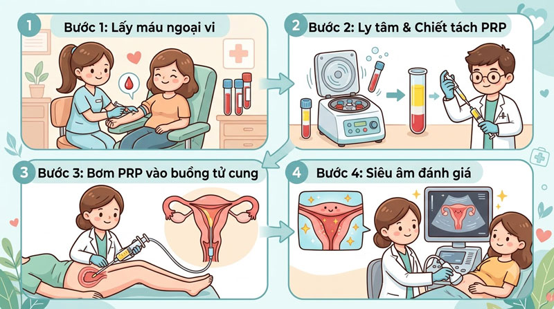quy trình bơm PRP làm dày niêm mạc tử cung