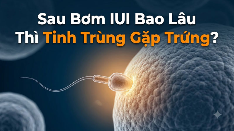 Sau Bơm IUI Bao Lâu Thì Tinh Trùng Gặp Trứng? Giải Đáp Chuẩn Y Khoa