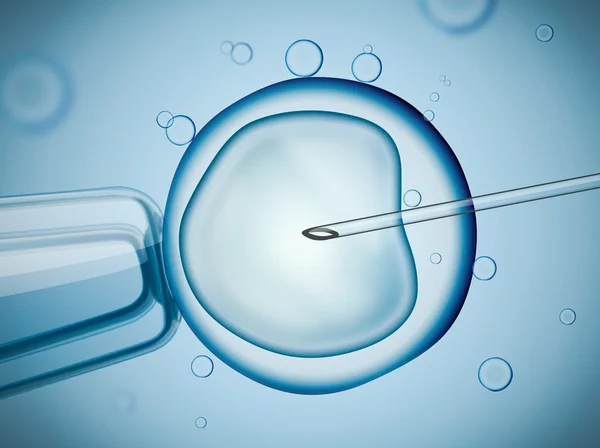 Thụ tinh ống nghiệm (IVF) & tiêm tinh trùng vào bào tương noãn (ICSI)
