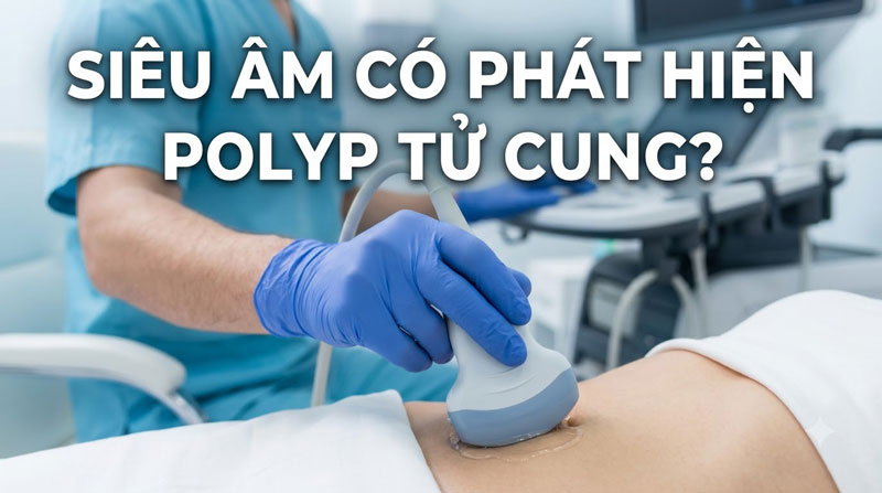 Siêu Âm Có Phát Hiện Polyp Tử Cung Không? Thời Điểm Siêu Âm Chính Xác Nhất