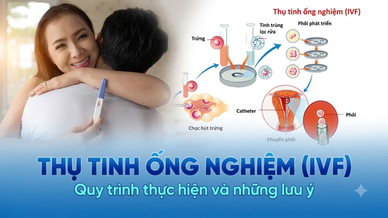 ivf là gì?
