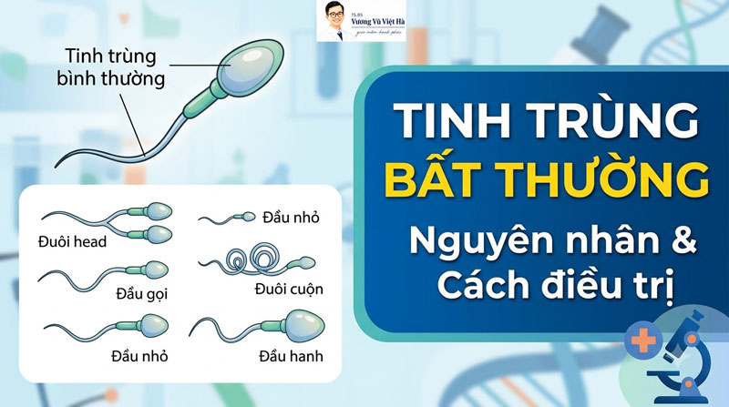 Tinh Trùng Dị Dạng: Nguyên Nhân, Tỷ Lệ Chuẩn WHO Và Hướng Cải Thiện Cho Nam Giới Mong Con