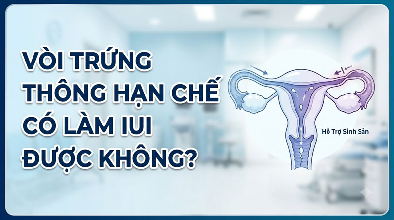 Vòi Trứng Thông Hạn Chế Có Làm IUI Được Không? Giải Đáp Chuẩn Y Khoa
